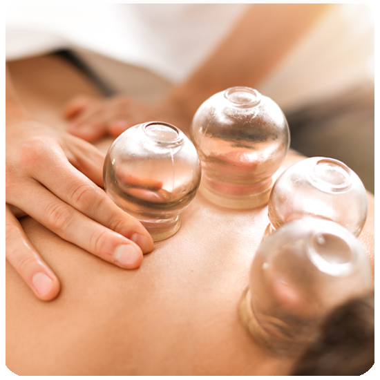 Cupping-Vitality-Wellness-Clinic