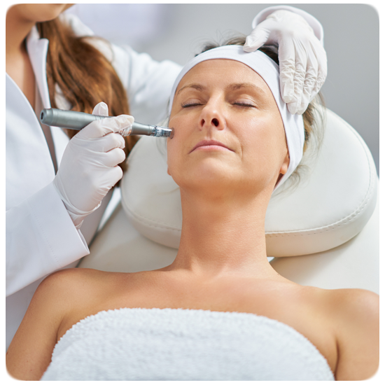 Microneedling Treatment
