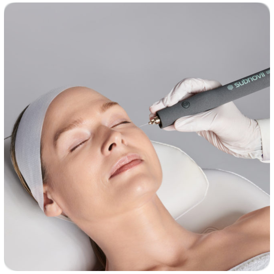 Subnovii Plasma Skin Resurfacing